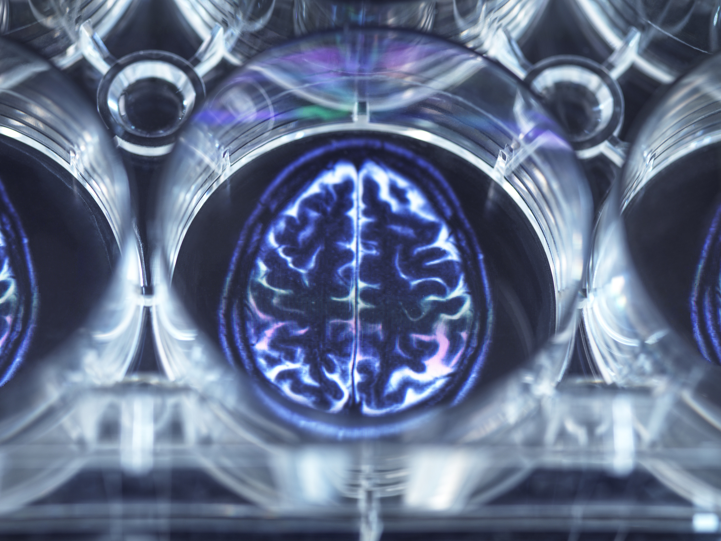 nanoparticules-cerveau